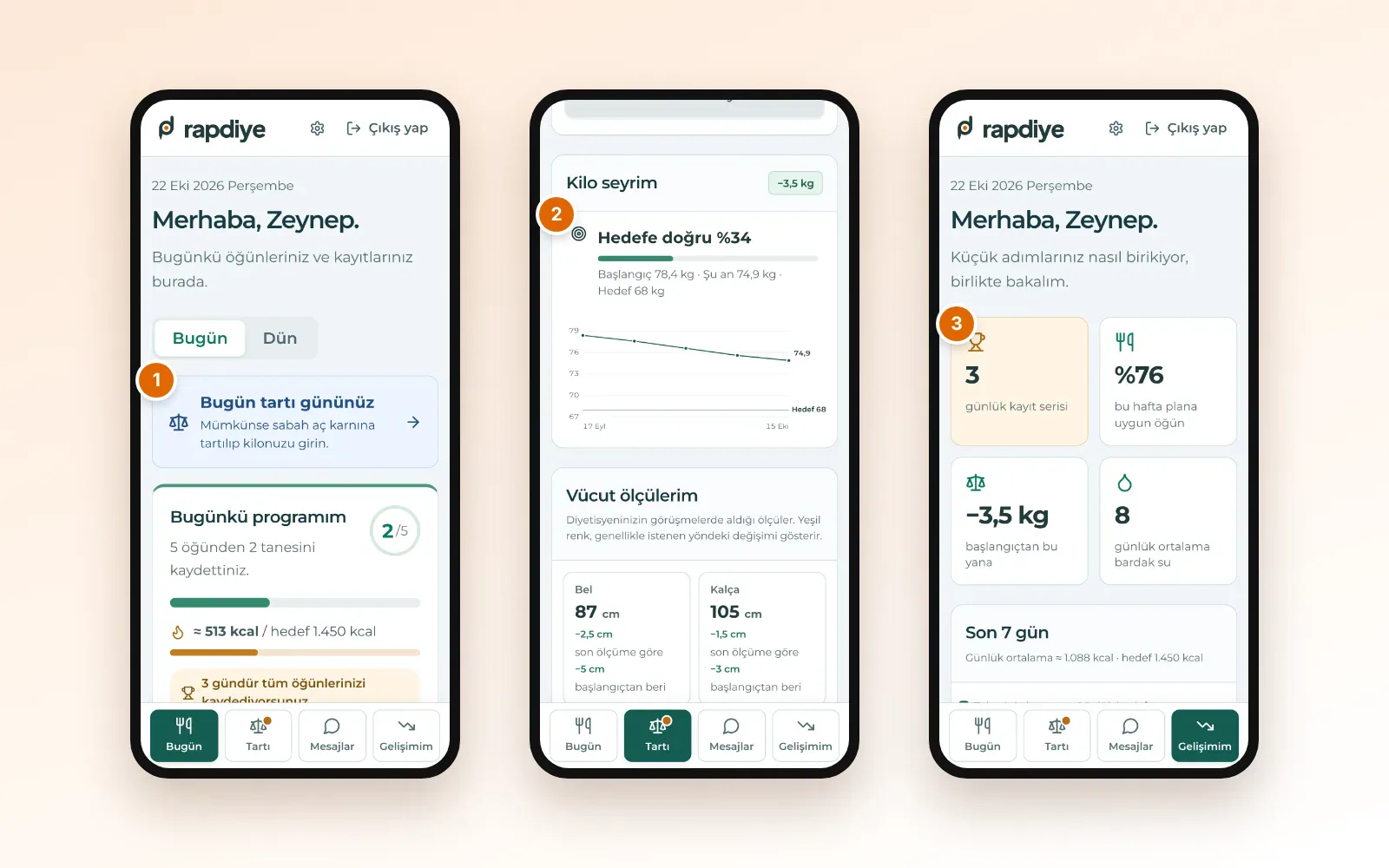 Danışan telefonunda üç ekran: Bugün ekranında tartı günü uyarısı, Tartı ekranında hedefe doğru yüzde 34 ve kilo grafiği, Gelişimim ekranında yüzde 76 uyum, eksi 3,5 kg ve 8 bardak su